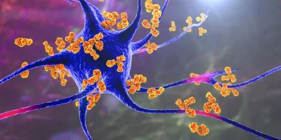 ARA-290 in Autoimmune Diseases ARA-290 in Autoimmune Diseases